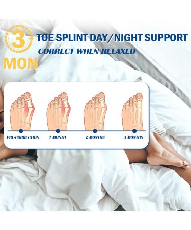 Bunion Corrector Kit - 6PCS Splint for Foot Pain Relief | Hallux Valgus Correction Day/Night Support - Women and Men - Buy Online on GoSupps.com