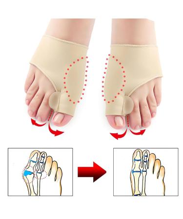 Bunion Corrector for Men & Women - Orthopedic Sock for Big Toe Pain Relief | Hallux Valgus Toe Straightener (2 Pack - Black - Buy Online on GoSupps.com