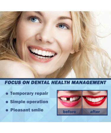 Provisional Denture Kit - Formable Tooth Repair Set for Missing Teeth | 3PCs Prosthesis Dental Care Tools - Buy Online on GoSupps.com