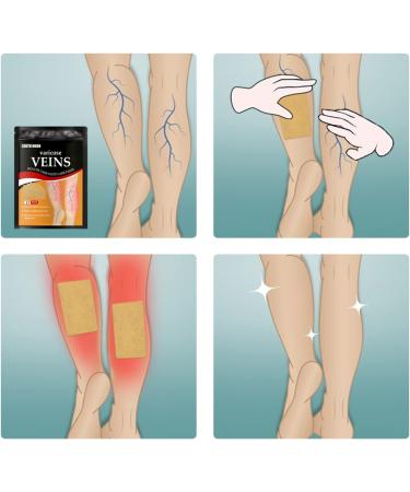 Xiyinli 12-Part Varicose Vein Health Paste - Skin-Friendly & Non-Toxic Relief for Swelling and Pain - Buy Online on GoSupps.com