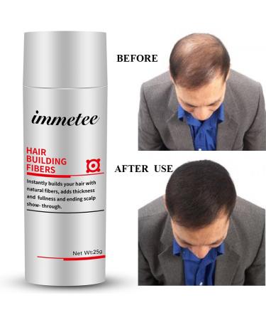IMMETEE Keratin Hair Building Fibers Powder - Conceal Thinning Hair, Cover Hair Loss - Dark Brown - 25g/0.88oz - Buy Online on GoSupps.com