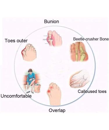 FFMA Women's Big Toe Correction Sandal - Orthopedic Bunion Corrector with Arch Support and Toe Straightening - Yellow, Size 11 - Buy Online on GoSupps.com