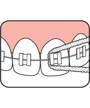 Tepe Bridge & Implant Floss - Premium Oral Care for Bridges and Implants - Buy Online on GoSupps.com