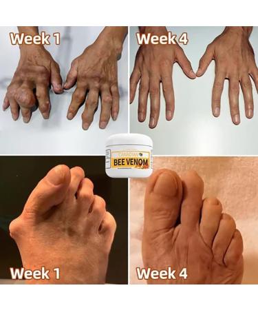 3PCS Bostore Canadian Bee Venom Alleviating Bone Pain Cvreoz Australian Honey Bee Cream New Zealand Bee Venom Joint Relief Cream Joint Relief Gel Pain Relief Cream - Buy Online on GoSupps.com