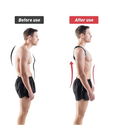 EGLGCC Posture Corrector for Women and Men - Adjustable Back Brace for Comfortable Upper Spine Support - Neck, Shoulder, Clavicle, and Back Pain Relief - Breathable Style 1 (Black) - Buy Online on GoSupps.com