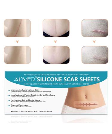Exceart Silicone Scar Sheets - Cica Care Gel Tape for Surgery, Burns, Acne Scars - 1 Box Scar Removal Sticker - Buy Online on GoSupps.com