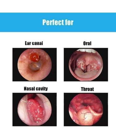 QIYUDS Ear Wax Removal Tool 3.9mm Endoscope Cleaner with LCD Screen & Storage Case - Buy Online on GoSupps.com