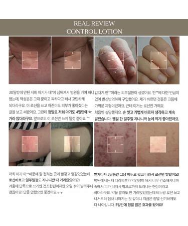 Buy Control Lotion 150ml - Hydrating Moisturizer for All Skin Types - International Shipping Available - Buy Online on GoSupps.com