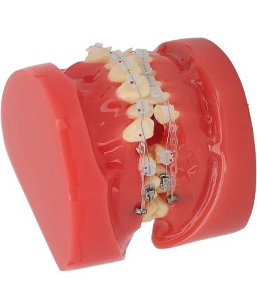 Orthodontic Model 24 Teeth with Metal Wire Case - Ideal for Dental Hospitals | International Shipping Available - Buy Online on GoSupps.com
