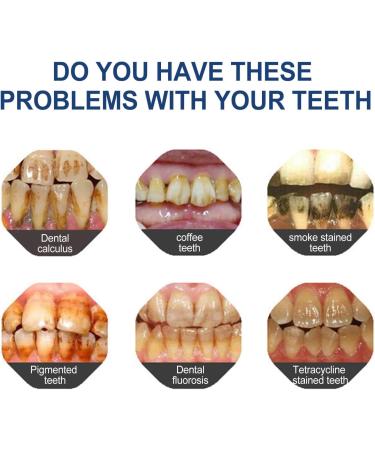 2024 New 1/2/3/4/5Pcs Power Teeth Whitening Gel Paint on Teeth Instant White | Extra Strong White Tooth Whitener for Sensitive Teeth | Instant Strong White Tooth Stain Removal Care for Brighter Smile - 5ml (4pcs Tooth Paint) - Buy Online on GoSupps.com