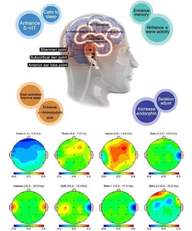 Sleepless Insomnia Therapy Device Anti-Sleep Drop Relief Anxiety Depression Headache  - Buy Online on GoSupps.com
