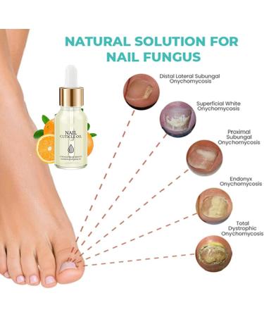 Oveallgo Huile riche en vitamines pour cuticules et cuticules des ongles s rum fortifiant pour la croissance des ongles renforce l'huile des ongles favorise la croissance rapide des ongles (mixte) - Buy Online on GoSupps.com