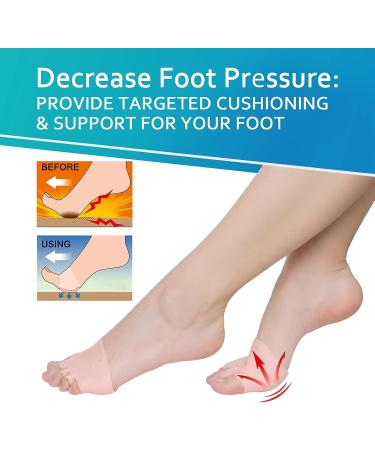 Metatarsal Pads & Toe Separator Set (3 Pairs) | Bunion Corrector & Toe Straightener | For Men & Women - Buy Online on GoSupps.com