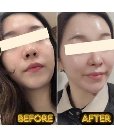 BNY Miracle Facial Peel 1.76 fl oz Mat Na Peel Da Sinh Hoc - Buy Online on GoSupps.com