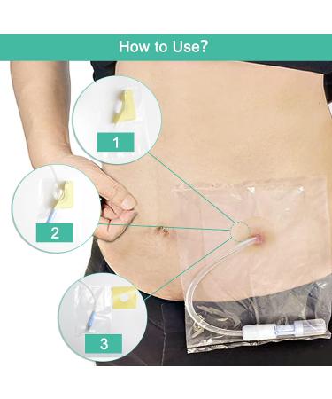 Waterproof Ostomy Protector G Tube Shower Cover Transfer Set 60pcs Peritoneal Dialysis Accessories Disposable Colostomy Bag for PD Port Catheter Supplies - 60 Count - Buy Online on GoSupps.com