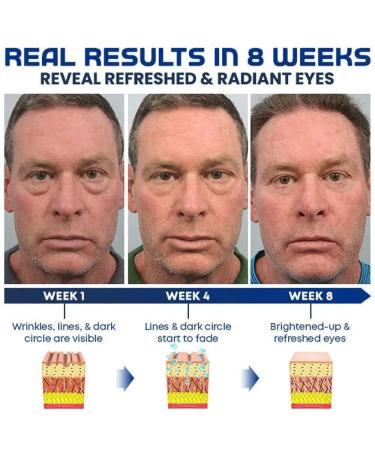 Openeyes Awaken Peptide Lifting Eye Gel - Pack of 3 - Buy Online on GoSupps.com