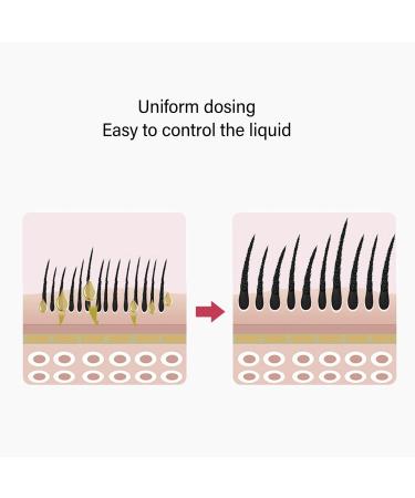 Generic Hair Oil Applicator 5ml Capacity Prevent Leakage Essential Oil Applicator Comb (White) - Buy Online on GoSupps.com