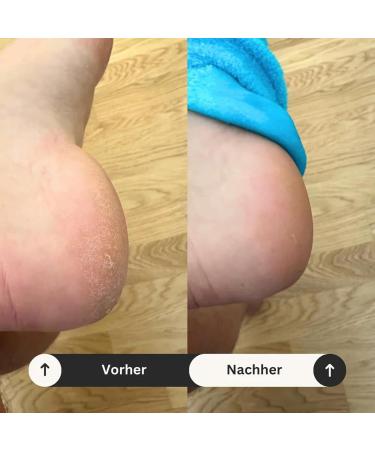  Goowafur Heel Socks for Dry Cracked Feet for Women Moisturizing Heel Socks 2 Soft Gel Socks | Warm Heel Support Pack for Foot Moisturizing and - Buy Online on GoSupps.com