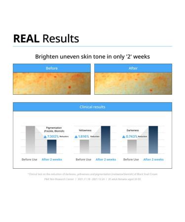 Buy Dr.G Black Snail Cream 50ml - Revitalize Your Skin | International Shipping Available - Buy Online on GoSupps.com