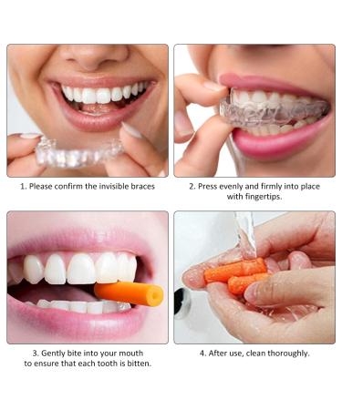 Aligner Tablet Seat Tray 12 Pieces of Aligner Chewies & Trays for Comfortable Orthodontic Treatment - Buy Online on GoSupps.com
