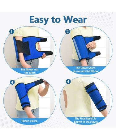 Elbow Splint for Cubital Tunnel Syndrome - Night Brace for Arthritis Pain Relief - Ulnar Nerve Support for Men and Women - Stabilizer Immobilizer Splint (L) - Buy Online on GoSupps.com