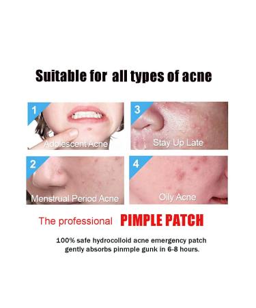Hydrocolloid Acne Patches for Face | Effective Pimple Treatment | International Shipping - Buy Online on GoSupps.com