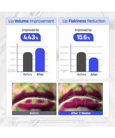 DERMATORY Hyalluron Peptide Volume Lip Mask Balm - Hydrating & Moisturizing Lip Mask for Day & Night Care (10ml) - Buy Online on GoSupps.com