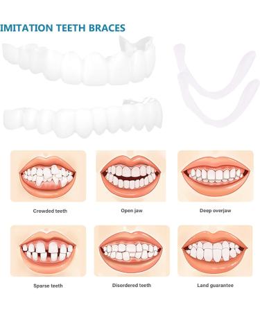 Frenzify Teeth Veneers - 1 Pair of Brightening Dentures for Men & Women | Cosmetic Prostheses for a Confident Smile | International Shipping - Buy Online on GoSupps.com