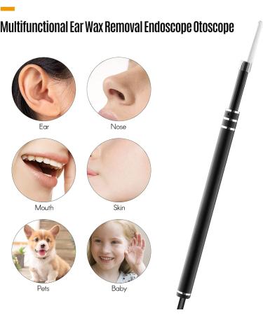 DSFEN 720P Visual Ear Cleaner | Ear Wax Removal Endoscope Otoscope | 1MP for Smartphone Tablet Computer | Cleaning Ear, Mouth, Nose, Skin, Pets, Baby - Buy Online on GoSupps.com