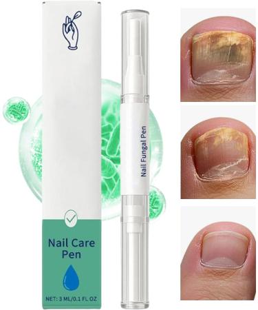 Filvczt Nail care pen with extra strength formula 3ml advanced Fungal nail pen ingrown nails Treatment precision tip natural and soft for men women adults - Buy Online on GoSupps.com