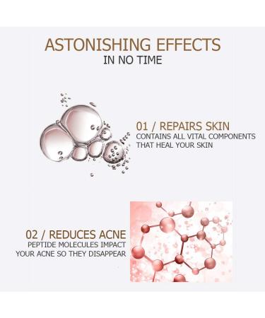 VENZEN Natural Organic Advanced Repair Skin Hyaluronic Solution 30ml | Hydrating Nicotinamide & Oligopeptide - International Shipping Available - Buy Online on GoSupps.com