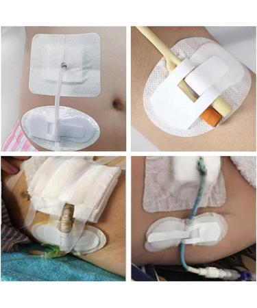 Catheter Legband Fixation Stickers Catheter Urine Tube Holder Ureter Fixators Medical Supplies Drainage Patch Stabilizer Covers for Men Elder Women (10 PCS) - Buy Online on GoSupps.com