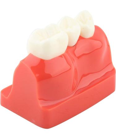 Implant Model Resin Dental Demonstration Demonstration Tooth Model Teeth Model Science Homework for Teaching Model School Dentist - Buy Online on GoSupps.com