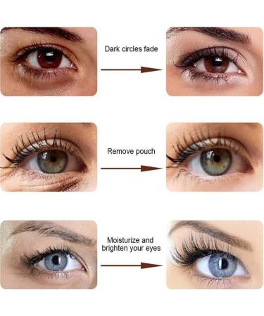  behound The Phix Caffeine Eye Cream Caffeine Eye Cream From Phix The Phix Caffeine Anti-Wrinkle Stay-Up Late Eye Cream Phix Caffeine Eye Cream for Dark Circles and Puffiness 57g (1 PCS) - Buy Online on GoSupps.com