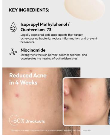 ACNO Anti-Acne Serum for Sensitive Skin - Gentle Blemish Treatment - Fragrance-Free & Non-Drying - 1 Fl Oz Acne Care - Buy Online on GoSupps.com