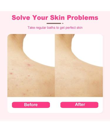 Kissfee African Net Sponge Body Exfoliating Bath Towel - Purple Back Scrubber for Skin Smoothing - Men and Women Washcloth - Buy Online on GoSupps.com