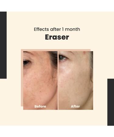 SkinTra - Eraser - Powerful Serum for Hyperpigmentation with 10% Vitamin C For Dark Spots & Redness Reduction Vegan Safe for Daily Use 30 ml/Net 1.01 Fl. Oz - Buy Online on GoSupps.com