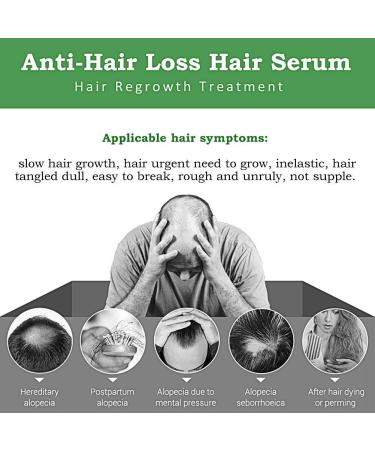 Ginger Hair Growth Serum - Stop Hair Loss & Thinning Treatment - 3 Pack 30ML - For Women & Men - Buy Online on GoSupps.com