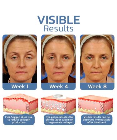 Lovilds & Openeyes Peptide Tight Eye Gel Rejuvenating Eye Lifting Gel for Men & Women (2PCs) Best International Shipping - Buy Online on GoSupps.com