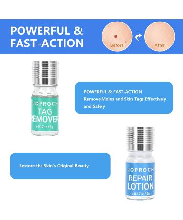 Skin Tag Remover - All Natural Mole and Skin Tag Removal Lotion - Scar-Free and Safe Solution - Buy Online on GoSupps.com