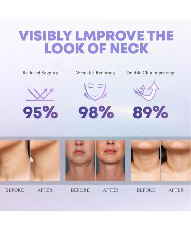 Neck Firming Cream - Anti-Aging Tightening & Lifting Formula for Youthful Skin | Reduce Fine Lines & Wrinkles (1.7 oz - Buy Online on GoSupps.com