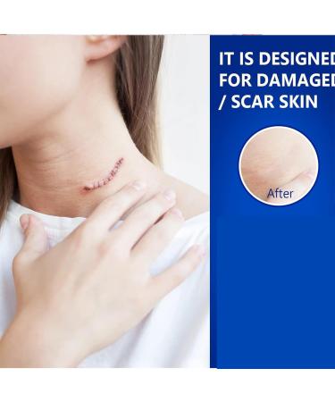 Advanced Scar Gel for Surgical Acne & Keloid Scars - Effective Scar Removal for Face & Body - 100% New - 2 Bottles - Buy Online on GoSupps.com