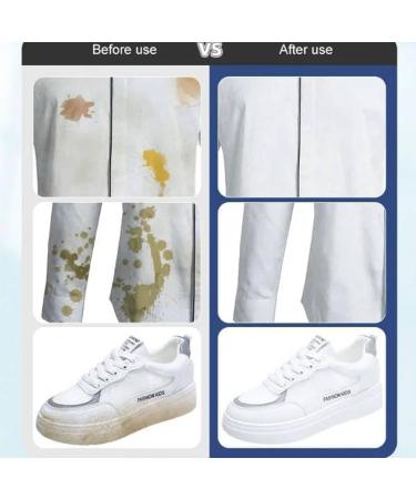 Stain Removal Wet Wipes Clothing Stain Removal Wet Wipes 20Pcs/Bag Stain Remover Wipes Decontamination Wipe Emergency Stain Rescue Stain Remover for Clothes Fabric Stain 2pc - Buy Online on GoSupps.com