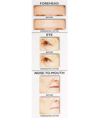 Peter Thomas Roth Instant FIRMx Face Tightener - Smooth Fine Lines, Deep Wrinkles & Pores - Buy Online on GoSupps.com