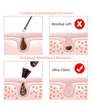 Blackhead Remover Pore Vacuum with Camera - WiFi HD Acne Extractor with Hot Compress, 4 Probes, 3 Suction Levels - USB Rechargeable - Gold - Buy Online on GoSupps.com
