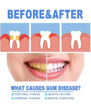 Gum Therapy Gel & Tooth Whitening Pen Set - Repair Protect & Reduce Inflammation - 5 Pieces - Buy Online on GoSupps.com