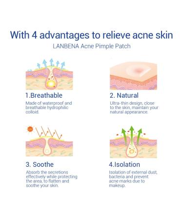 Tristar Beauty Acne Patches Hypoallergenic Hydrocolloid Invisible Pimple & Blemish Spot Treatment (48 Patches) - Fast International Shipping - Buy Online on GoSupps.com