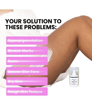 Moona Jolie Target Area Cream Face & Body Moisturizer with Vitamin C Aloe & SPF 50 Supports Even Skin Tone & Smooth Nourished Skin (250ML) 8.45 Ounce (Pack of 1) - Buy Online on GoSupps.com