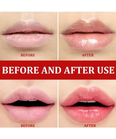 10g Lip Whitening Essence Gel - Lighten Wrinkles, Exfoliate, Moisturize - Skin Care - Buy Online on GoSupps.com