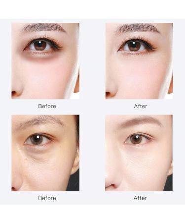 RABIOTA Hyaluronic Acid Under Eye Patches - 30 Pairs Anti-Aging Gel Pads for Dark Circles & Puffiness - Buy Online on GoSupps.com